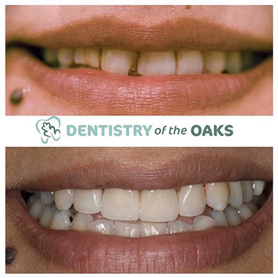 Picture two of our top rated dental work